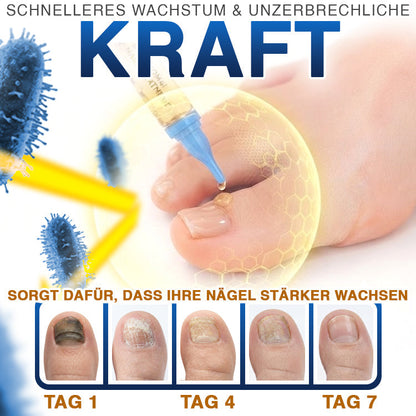 🇩🇪 CareBreeze® Fungi Free Bienengift-Nagelbehandlung ✨