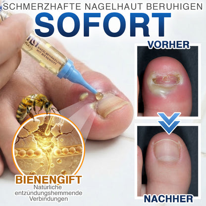 🇩🇪 CareBreeze® Fungi Free Bienengift-Nagelbehandlung ✨
