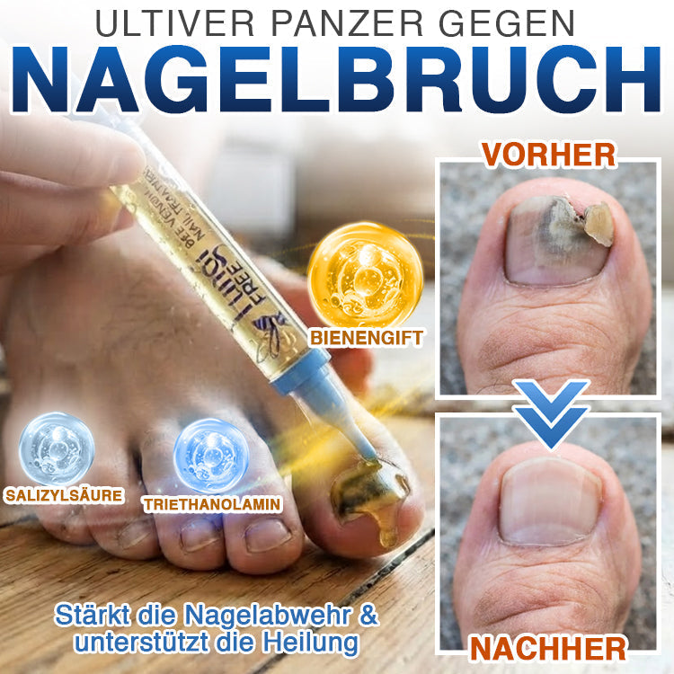 🇩🇪 CareBreeze® Fungi Free Bienengift-Nagelbehandlung ✨