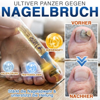 🇩🇪 CareBreeze® Fungi Free Bienengift-Nagelbehandlung ✨